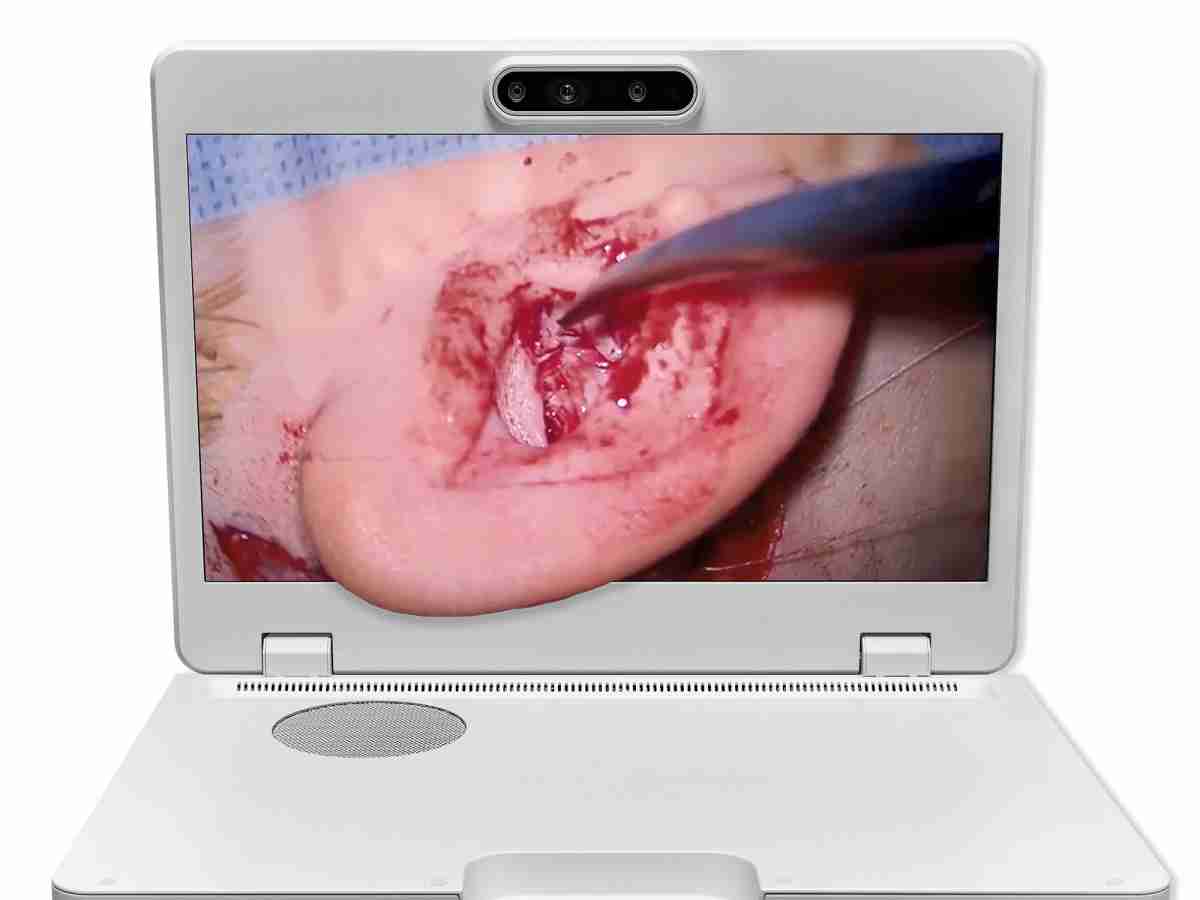 达擎之＂Heads-up 3D显微手术显示系统＂，，，，整合4K裸眼3D显示及眼球追踪系统，，具备快速追踪人眼移动位置功能，，减轻医师长时间维持固定姿势的负担，，，，让医师能有更宽广清晰的3D立体视野及更舒适的姿势来执行手术。。